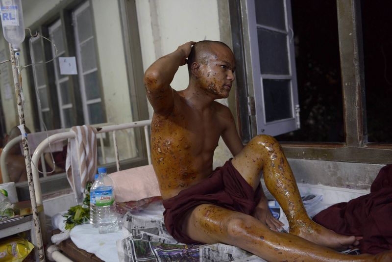 This file picture taken on December 3, 2012 shows a Buddhist monk who was injured in a crackdown MONYWA AFP