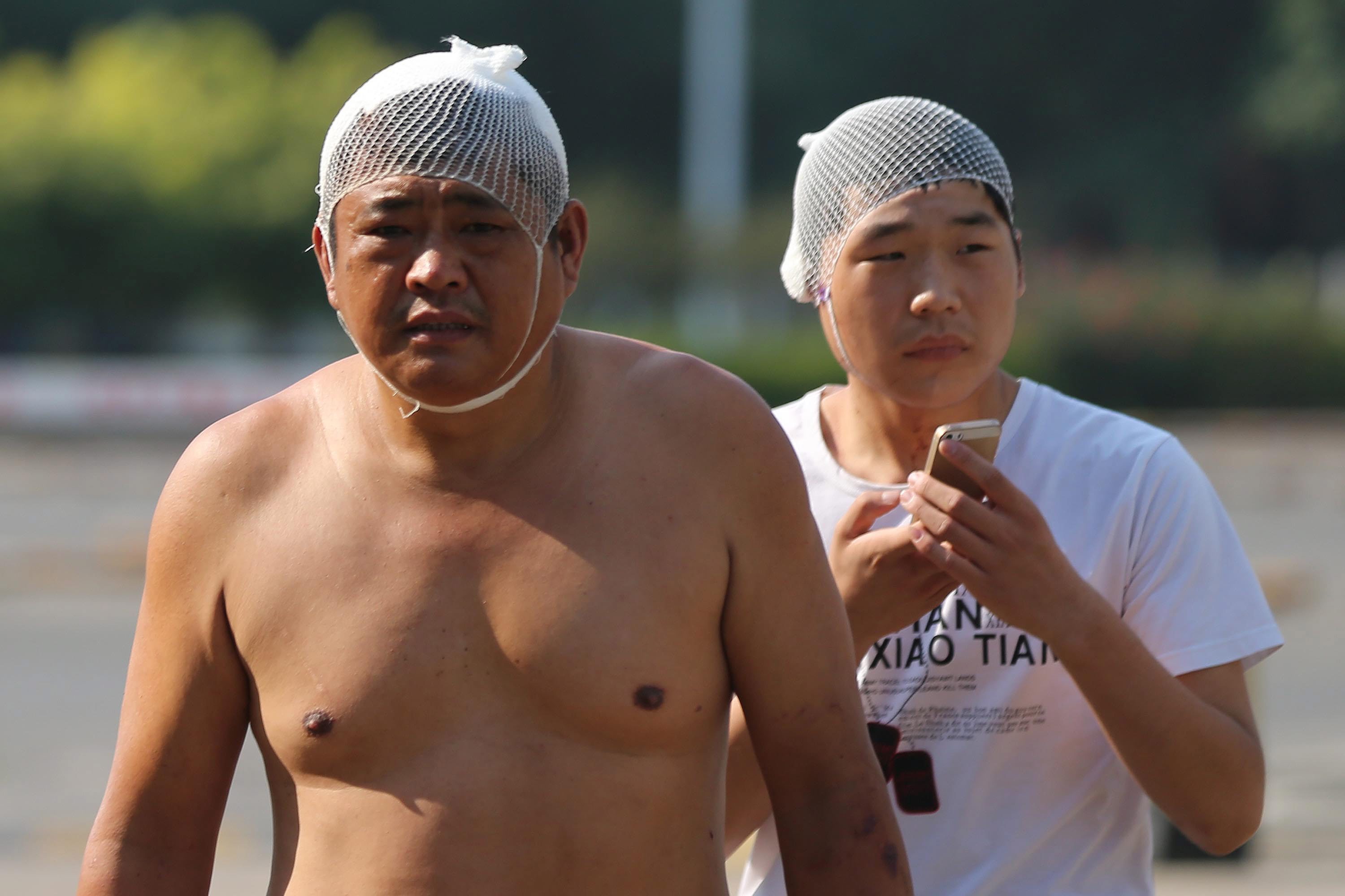 Injured men wearing head bandages are seen on the street after the explosion.